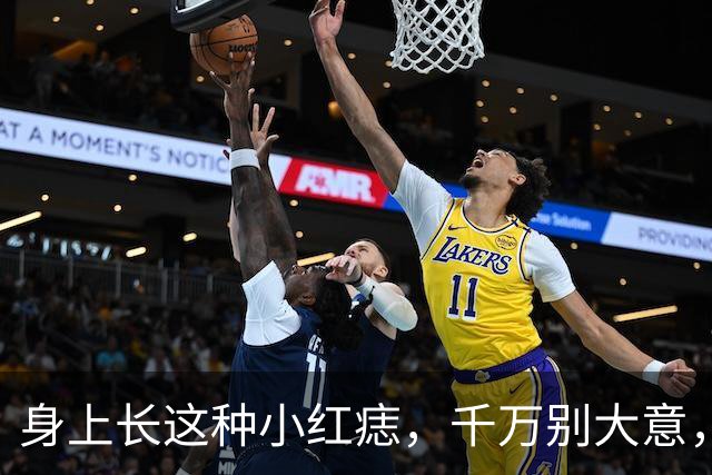 身上长这种小红痣，千万别大意，是大病来临的征兆？告诉你真相